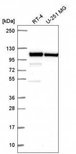 Anti-CTNNA1 antibody produced in rabbit HPA063535-100UL