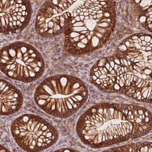 Anti-CTNNA1 antibody produced in rabbit HPA046119-100UL
