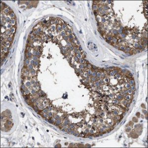 Anti-CTNNA3 antibody produced in rabbit HPA017977-100UL