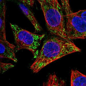 Anti-CTNNBIP1 antibody produced in rabbit 