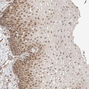 Anti-CTNNBL1 antibody produced in rabbit HPA027907-100UL