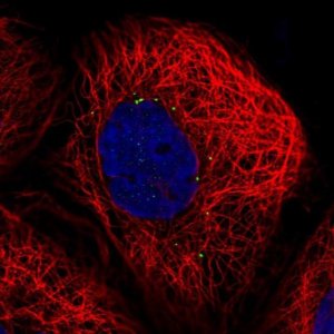 Anti-CTNS antibody produced in rabbit 