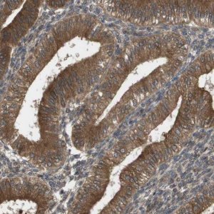 Anti-CTPS2 antibody produced in rabbit 
