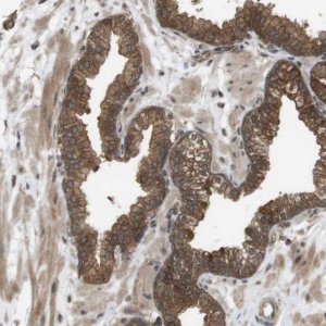 Anti-CTPS2 antibody produced in rabbit 