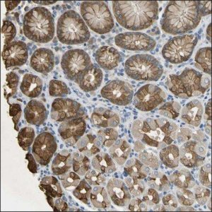 Anti-CTSE antibody produced in rabbit HPA008021-100UL