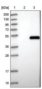 Anti-CTSE antibody produced in rabbit HPA008021-100UL