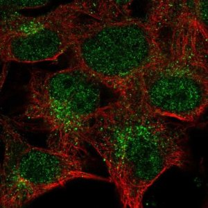 Anti-CTSK antibody produced in rabbit 
