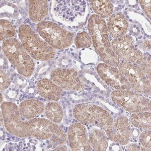 Anti-CTU1 antibody produced in rabbit 