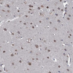 Anti-CTU2 antibody produced in rabbit 