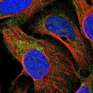 Anti-CTU2 antibody produced in rabbit 