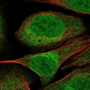 Anti-CUEDC2 antibody produced in rabbit 