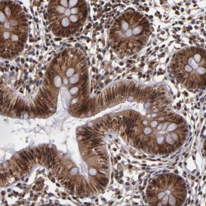 Anti-CUL5 antibody produced in rabbit 