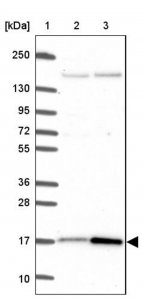 Anti-CUTA antibody produced in rabbit 