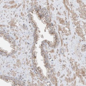Anti-CUX1 antibody produced in rabbit 