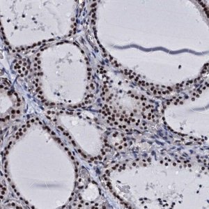 Anti-CWC15 antibody produced in rabbit 