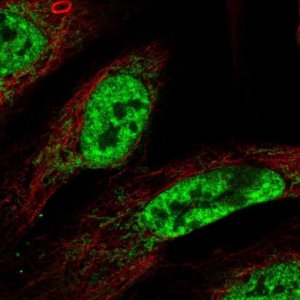 Anti-CWC15 antibody produced in rabbit 