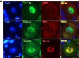 Anti-CWC22 antibody produced in rabbit 
