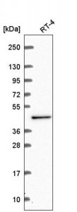 Anti-CWC27 antibody produced in rabbit 