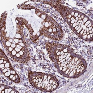 Anti-CX3CL1 antibody produced in rabbit 