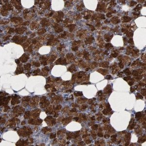 Anti-CXADR antibody produced in rabbit 