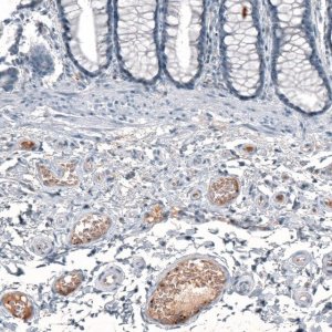 Anti-CXCL8 antibody produced in rabbit 