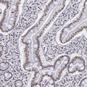 Anti-CXorf21 antibody produced in rabbit 