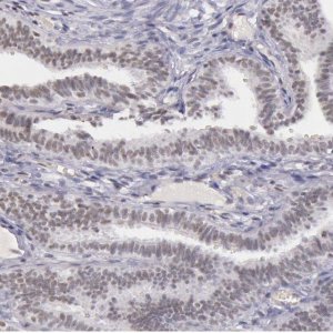 Anti-CXorf21 antibody produced in rabbit 