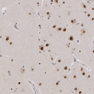 Anti-CXorf23 antibody produced in rabbit 