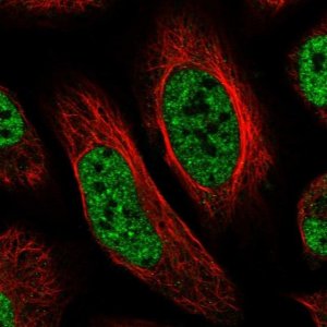 Anti-CXorf23 antibody produced in rabbit 