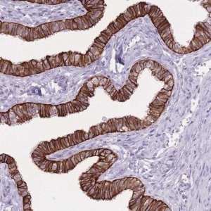 Anti-CXORF57 antibody produced in rabbit 