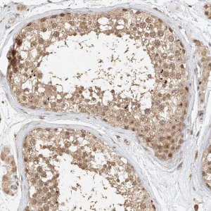 Anti-CXorf58 antibody produced in rabbit 
