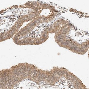 Anti-CXorf58 antibody produced in rabbit 