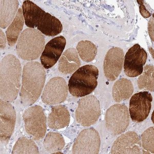 Anti-CXorf65 antibody produced in rabbit 