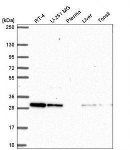 Anti-CXXC5 antibody produced in rabbit 