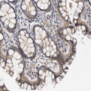 Anti-CYB561 antibody produced in rabbit 