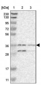 Anti-CYB561 antibody produced in rabbit 