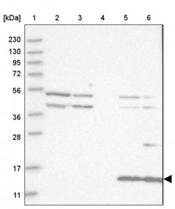 Anti-CYB561D1 antibody produced in rabbit 