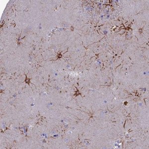 Anti-CYB561D2 antibody produced in rabbit 