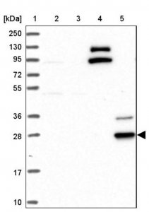 Anti-CYB561D2 antibody produced in rabbit 