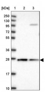 Anti-CYB5R2 antibody produced in rabbit 