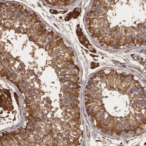 Anti-CYB5R3 antibody produced in rabbit 
