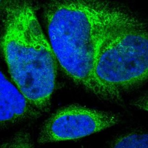 Anti-CYB5R3 antibody produced in rabbit 