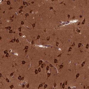 Anti-CYFIP1 antibody produced in rabbit 