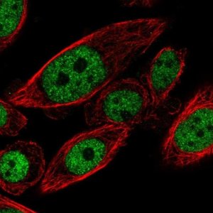 Anti-CYHR1 antibody produced in rabbit HPA059543-100UL