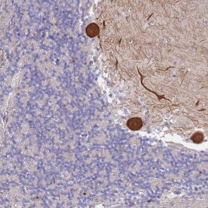 Anti-CYLD antibody produced in rabbit 