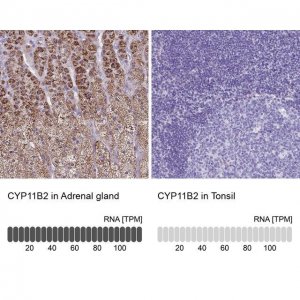 Anti-CYP11B2 antibody produced in rabbit 