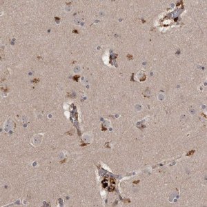 Anti-CYP1B1 antibody produced in rabbit 