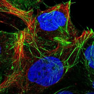 Anti-CYP20A1 antibody produced in rabbit 