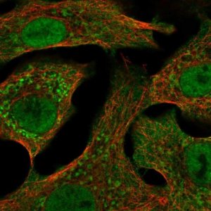 Anti-CYP24A1 antibody produced in rabbit 