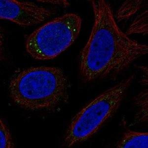 Anti-CYP27C1 antibody produced in rabbit 